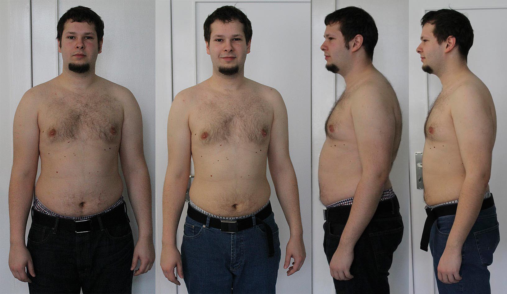 Живот до и после похудения мужчины