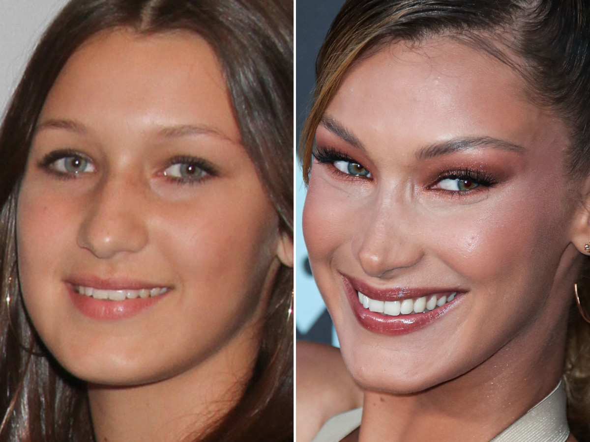 5171166 5171141 another example, bella hadid before and after. she was pret...
