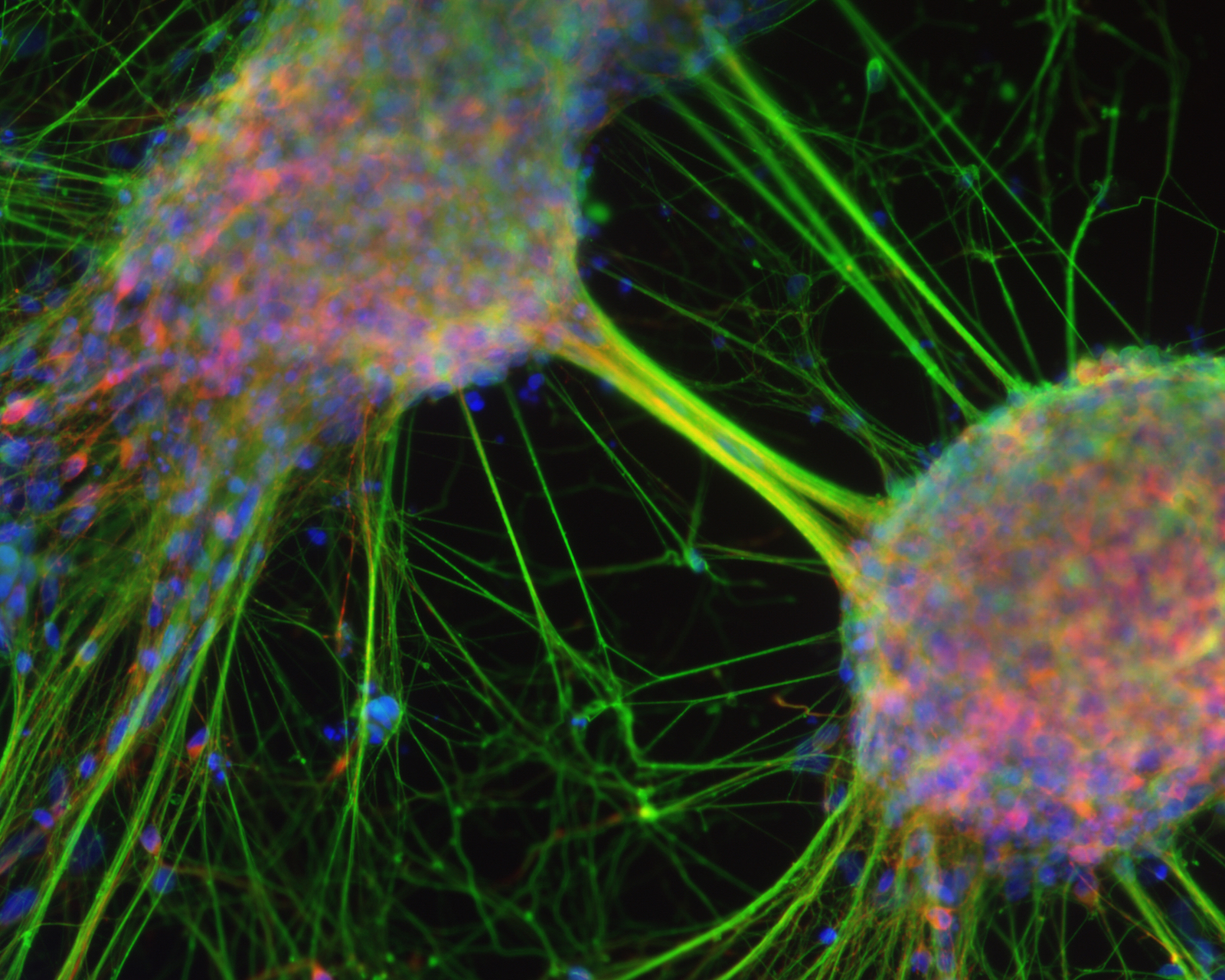 Микро клеток. Стволовые клетки микрофотография. Стволовые клетки в микроскопе. Нейрональные стволовые клетки. Клетка в микроскопе.