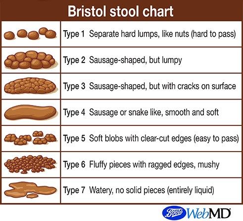 The Bristol Stool Chart Nhs